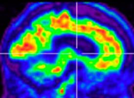 heat map site